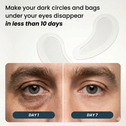 SharpEyes Patches | New Generation