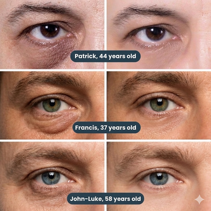 SharpEyes Patches | New Generation